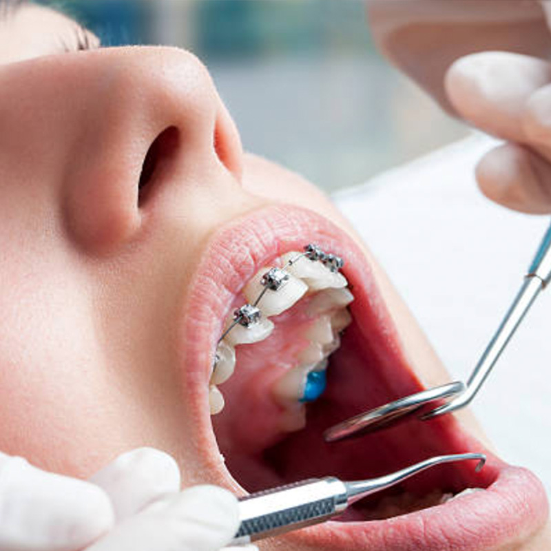 Dental braces checkups Adelaide