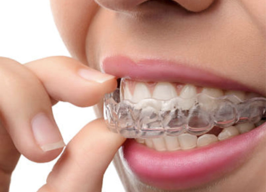 Invisalign Experts Adelaide | Adelaide Orthodontists - Speciality Orthodontists in Adelaide, South Australia